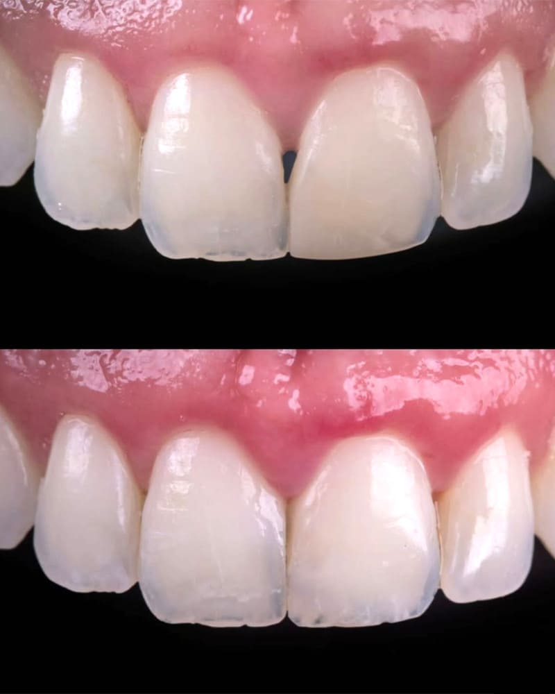 igor-fotos-smartphone-1b