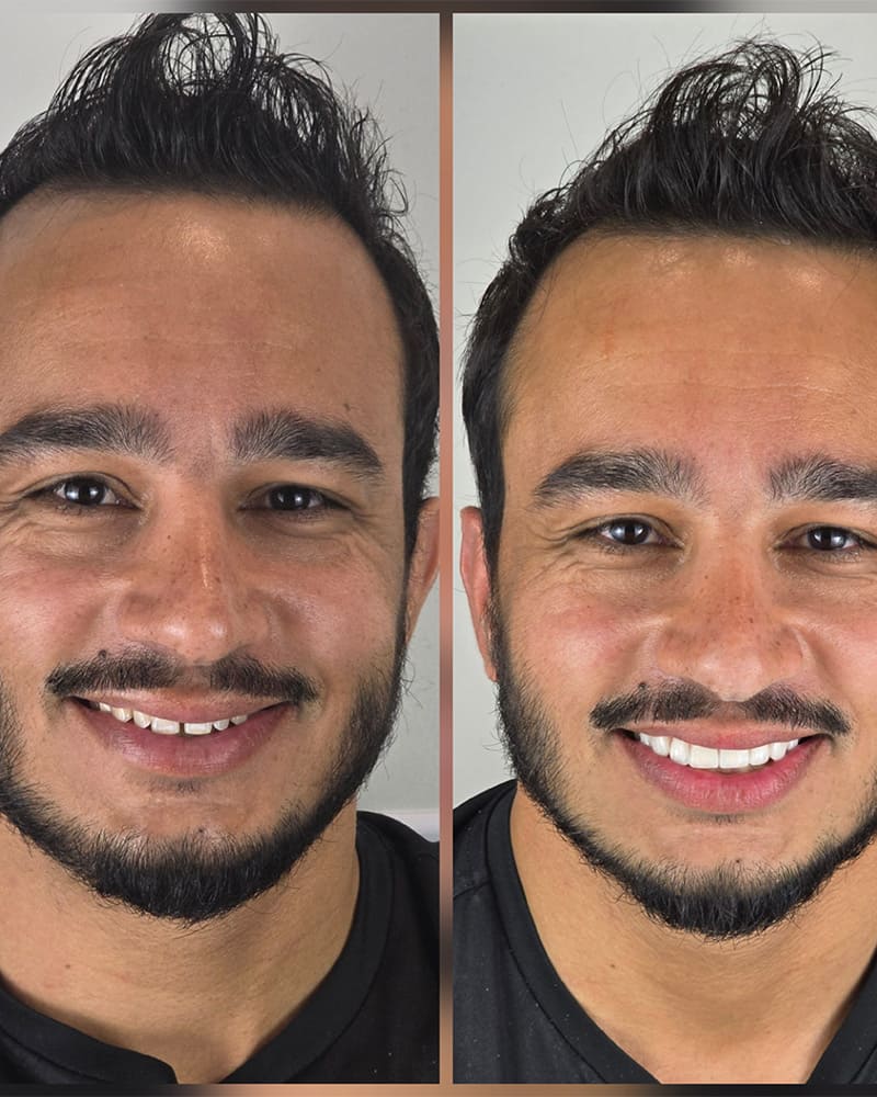 igor-fotos-smartphone-2b