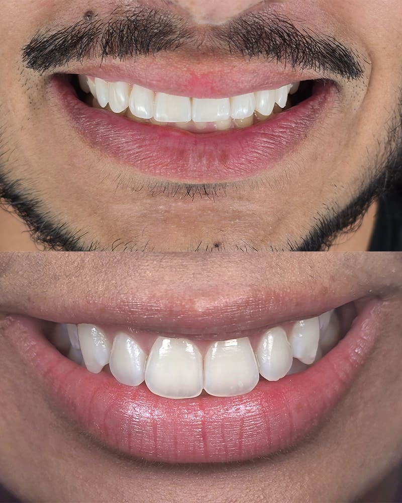 igor-fotos-smartphone-4b